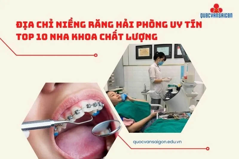 Địa Chỉ Niềng Răng Hải Phòng Uy Tín Top 10 Nha Khoa Chất Lượng